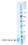 TIGIT (Human, Recombinant, HEK293) Fusion Tag: C-terminal 8xHis